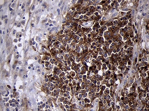 MME / CD10 Antibody (aa411-750, clone OTI2A4)