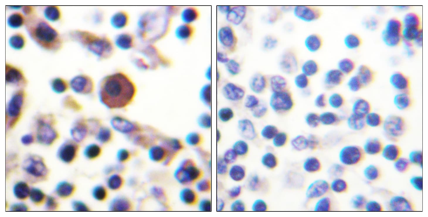 Polyclonal Rabbit anti-Human IL9R / CD129 Antibody (aa472-521, IHC)