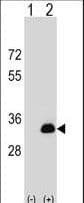 Polyclonal Rabbit anti-Human DOK5 Antibody (aa21-49, WB)