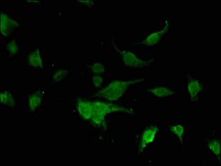 FOXK1 / MNF Antibody