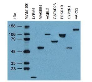 Monoclonal Mouse MYC / c-Myc Antibody (aa408-432, IF, WB)
