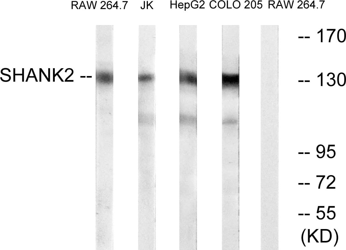 IHC-plus™ SHANK2 / SHANK Antibody (aa331-380)