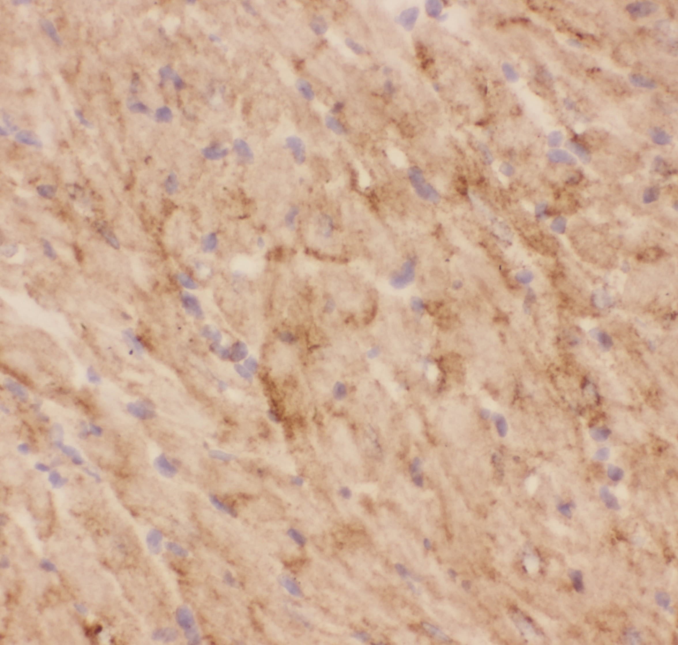 SLC2A4 / GLUT-4 Antibody (aa333-509)