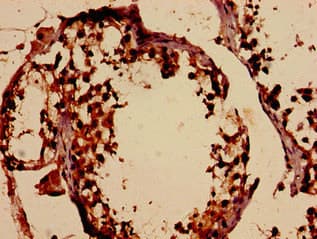 Polyclonal Rabbit anti-Human DMC1 Antibody (IHC, IF, WB)