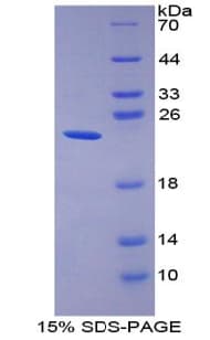 Human GKN2 / Gastrokine 2 Protein (Recombinant His)