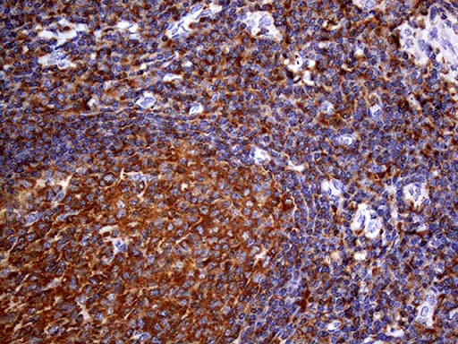 Monoclonal Mouse anti-Human URP2 / FERMT3 Antibody (clone OTI2H10, aa259-528, IHC, WB)