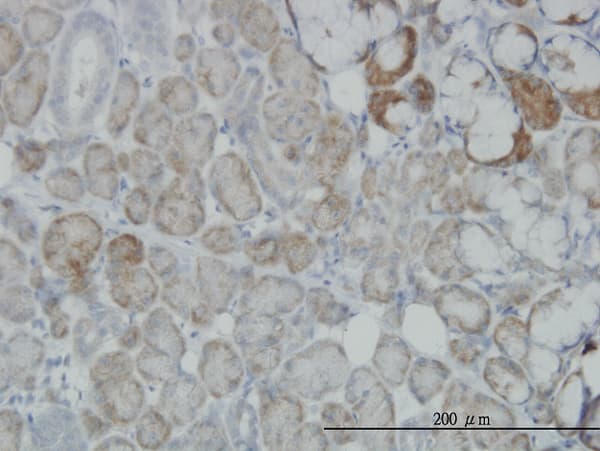 OXSR1 / OSR1 Antibody (clone 3A8)