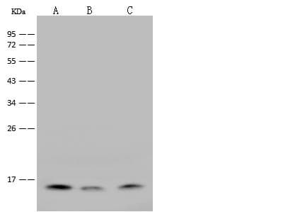IL21 Antibody