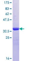 Human OSTM1 Protein (Recombinant GST, N-terminus)