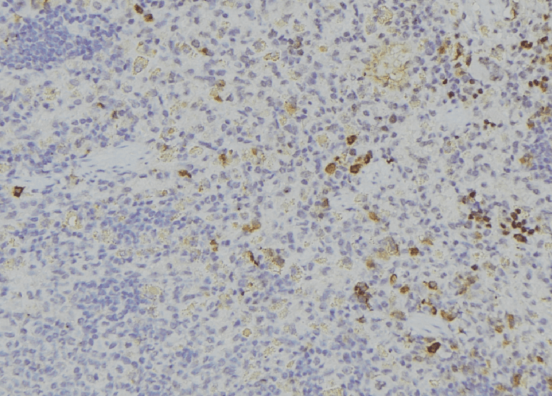 Polyclonal Rabbit anti-Human ITLN1 / Omentin Antibody (IHC, IF, WB)