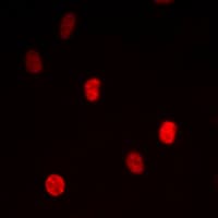 MED24 / TRAP100 Antibody (C-Terminus)
