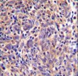 THEMIS / SPOT Antibody (aa559-588)