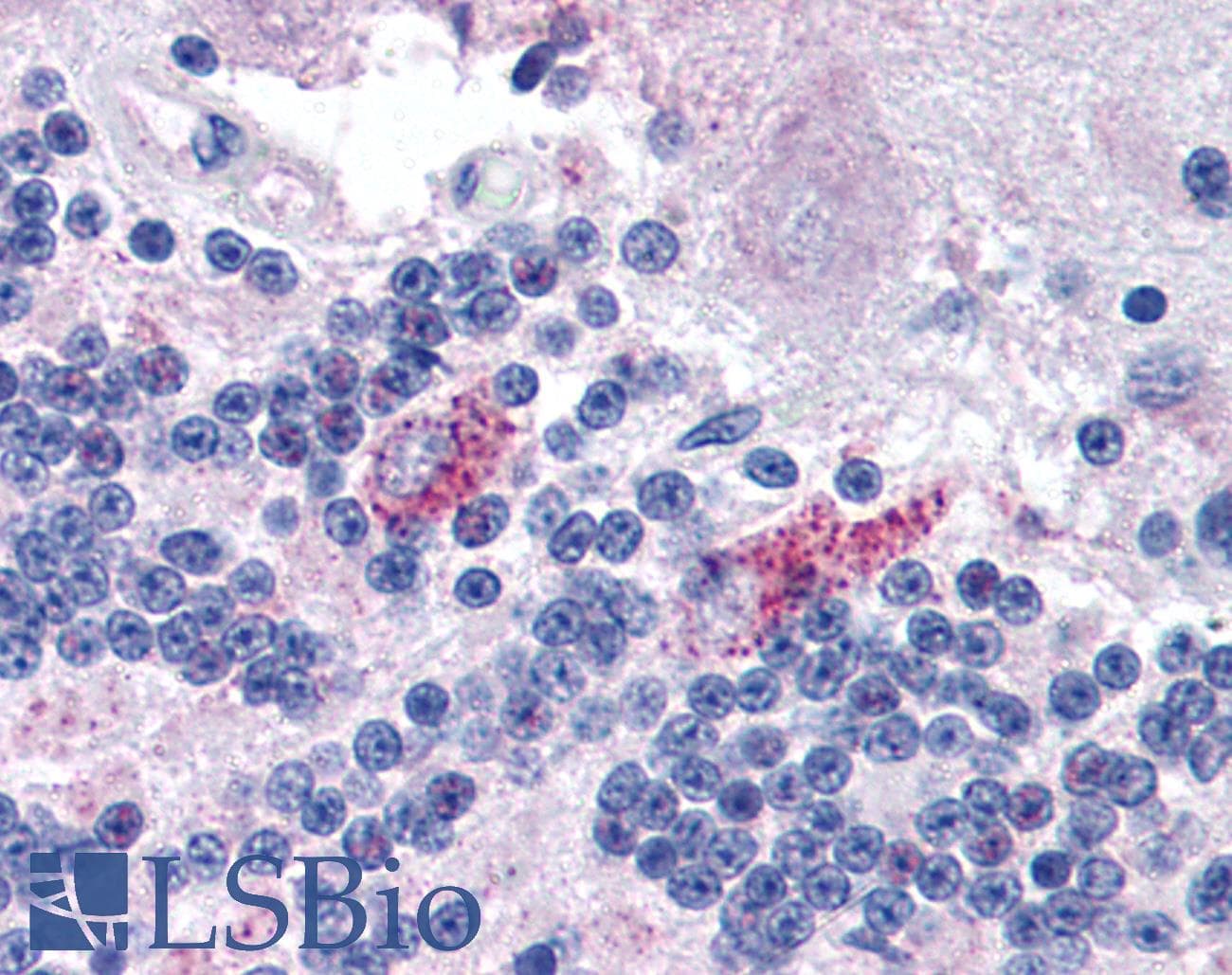 IHC-plus™ FXR2 Antibody (aa414-658, clone 1G2)