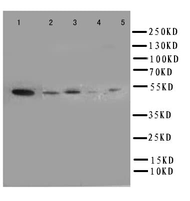 ANXA7 / Annexin VII / SNX Antibody (aa445-460)