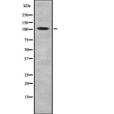 BACH1 Antibody