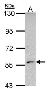 CYP21A2 Antibody