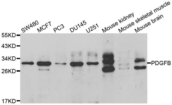 PDGF-BB Antibody