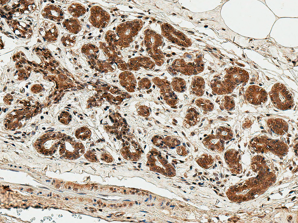 ER Alpha / Estrogen Receptor Antibody (Biotin)