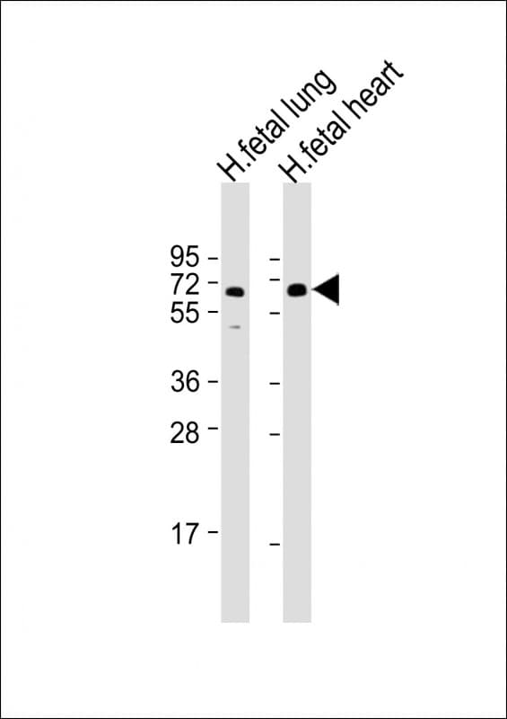 Polyclonal Rabbit anti-Human CDG1C / ALG6 Antibody (Internal, WB)