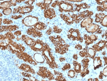 TPO / Thyroid Peroxidase Antibody (clone TPO/1922)