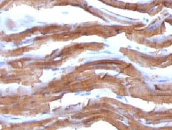 Muscle Actin Antibody (clone PMAC1-1, Ready-to-Use)
