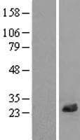 LRRC20 Protein (Over-Expression Lysate Myc-DDK (Flag))