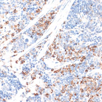Polyclonal Rabbit anti-Human HMG-CoA Reductase / HMGCR Antibody (IHC, WB)