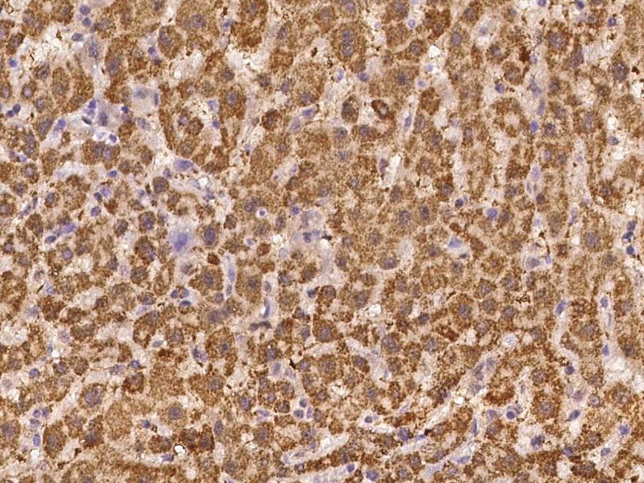 Polyclonal Rabbit anti-Human IKZF4 / EOS Antibody (IHC)