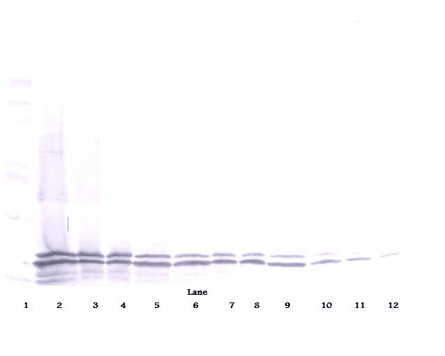 TNFRSF13B / TACI Antibody