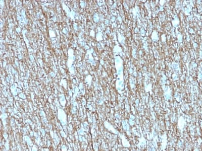 NEFH / NF-H Antibody (clone rNF421)
