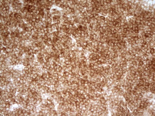 PRMT5 Antibody (aa238-499, clone OTI2C12)