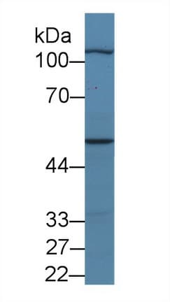 MYPN Antibody (aa945-1320, Cy3)