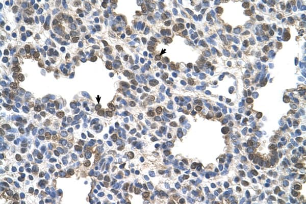BCHE / Cholinesterase Antibody (aa151-200)