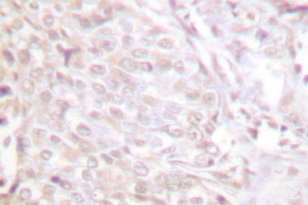 Polyclonal Rabbit anti-Human NFKB1 / NF-Kappa-B Antibody (Gln332, IHC, IF, WB)