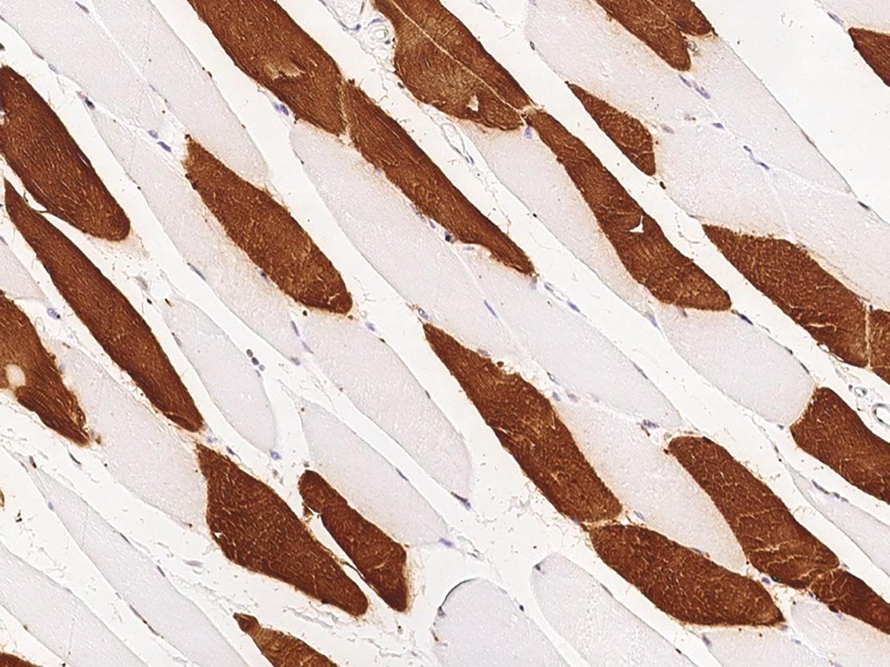 Polyclonal Rabbit anti-Human TNNI2 Antibody (Preservative Free, IHC, IF, WB)