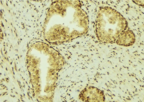LCN2 / Lipocalin 2 / NGAL Antibody