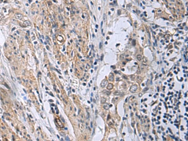 MBL2 / Mannose Binding Protein Antibody