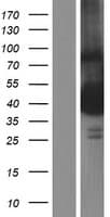 TTC5 Protein (Over-Expression Lysate Myc-DDK (Flag))