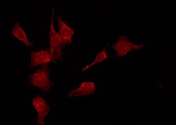 SMAD3 Antibody (phospho-Ser208)