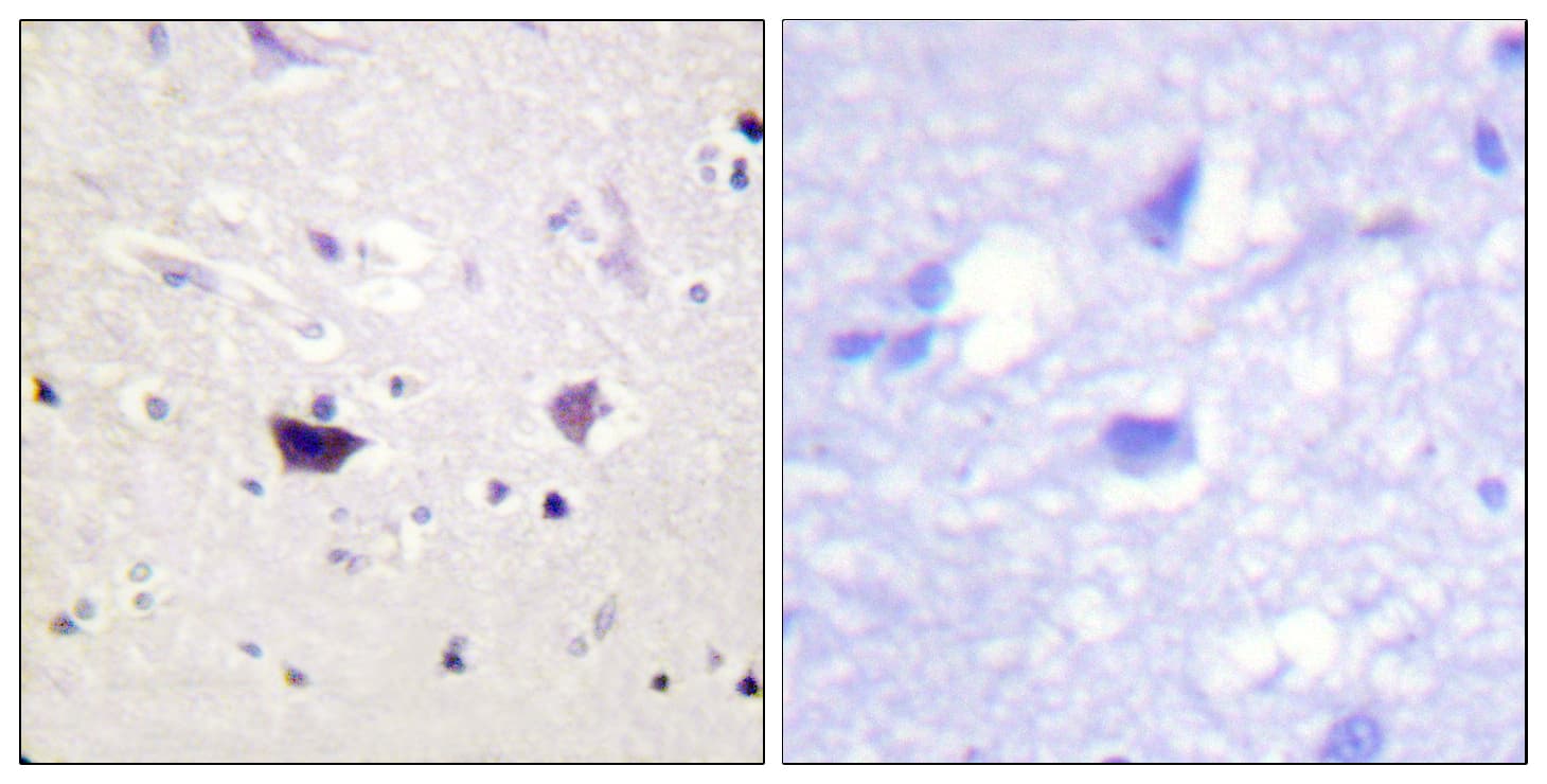 Polyclonal Rabbit anti-Human PAK1 + PAK2 + PAK3 Antibody (aa111-160, IHC)