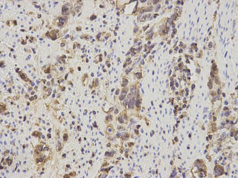 IHC-plus™ Calgizzarin / S100A11 Antibody