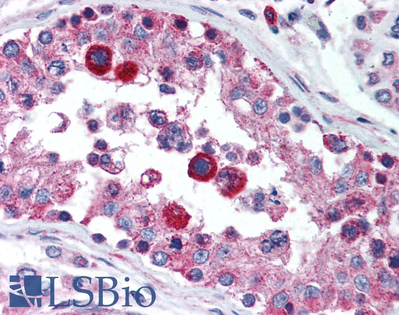PathPlus™ HAVCR1 / KIM-1 Antibody