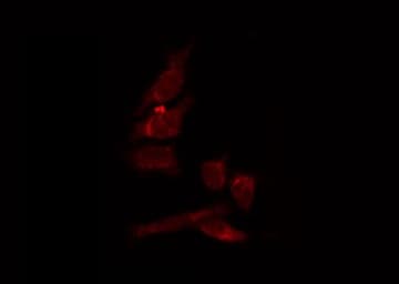 Polyclonal Rabbit anti-Human PMEL / SILV / gp100 Antibody (IHC, IF, WB)