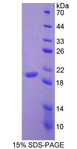 Mouse LECT2 Protein (Recombinant His,N-terminus)