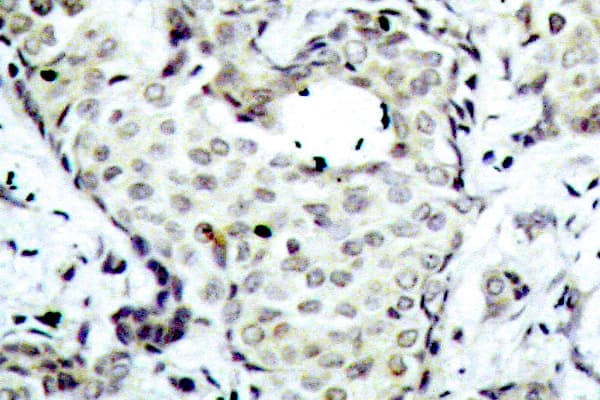 Polyclonal Rabbit anti-Human MAP2K6 / MEK6 / MKK6 Antibody (Ser201, IHC, WB)