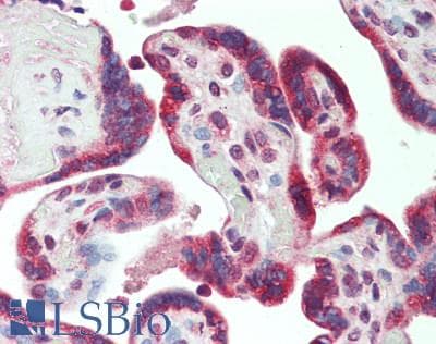 IHC-plus™ Polyclonal Rabbit anti-Human ADM / Adrenomedullin Antibody (IHC, WB)