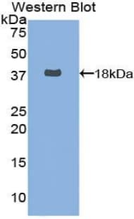 FASN / Fatty Acid Synthase Antibody (aa26-78, FITC)