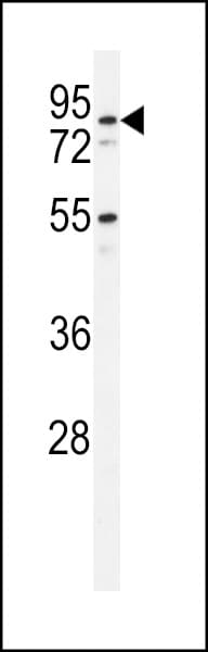 Polyclonal Rabbit anti-Human PDXDC1 Antibody (aa759-788, IHC, WB)