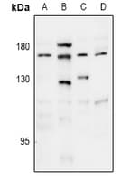 THBS1 / Thrombospondin-1 Antibody