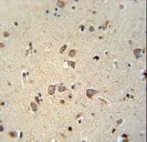 Polyclonal Rabbit anti-Human NIPAL4 Antibody (aa9-37, IHC, WB)